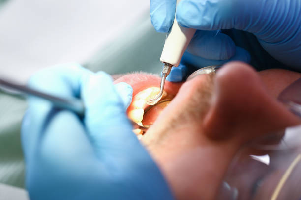 Best Pediatric Emergency Dentist in Weatherford, TX