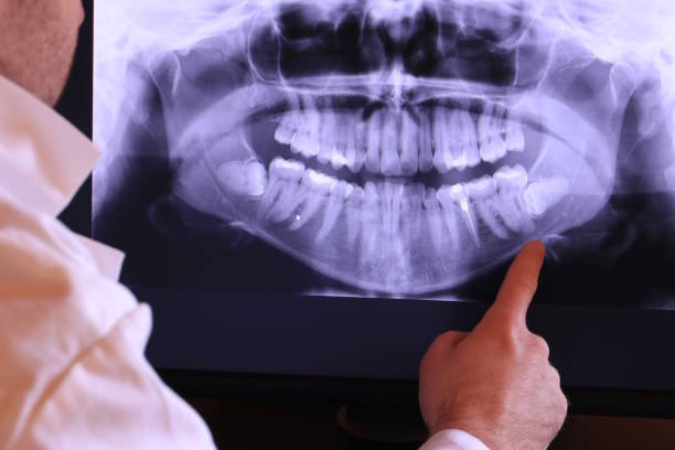 Best After-Hours Emergency Dentist in Weatherford, TX