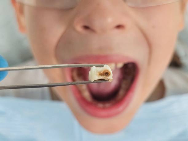 Best Same-Day Emergency Dentist in Weatherford, TX
